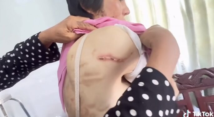 Sự im lặng của nạn nhân khiến chính quyền khó xử lý